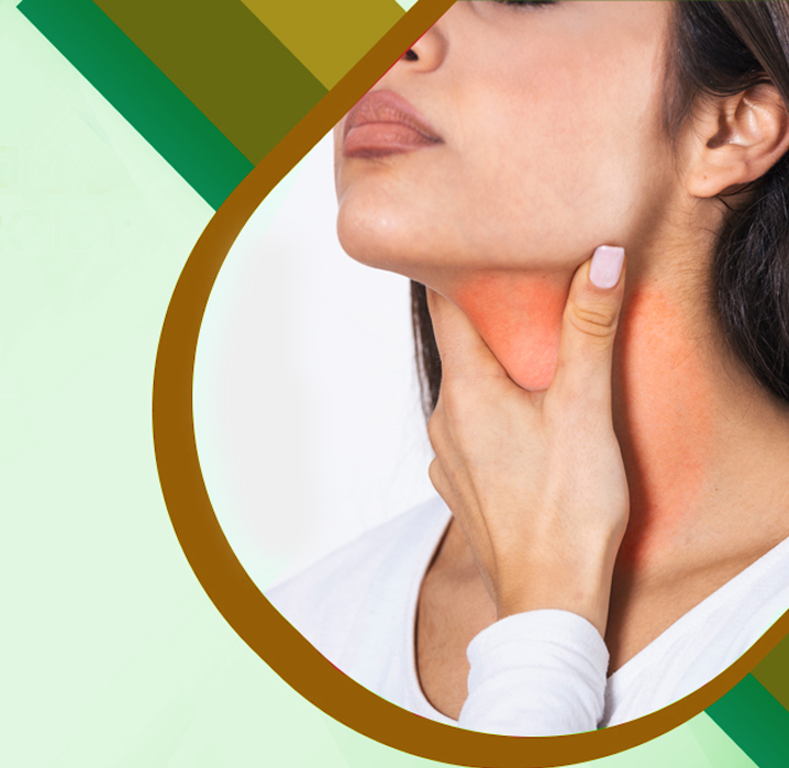 Support goiter management