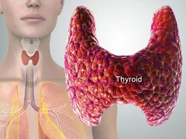 Thyroid disorders